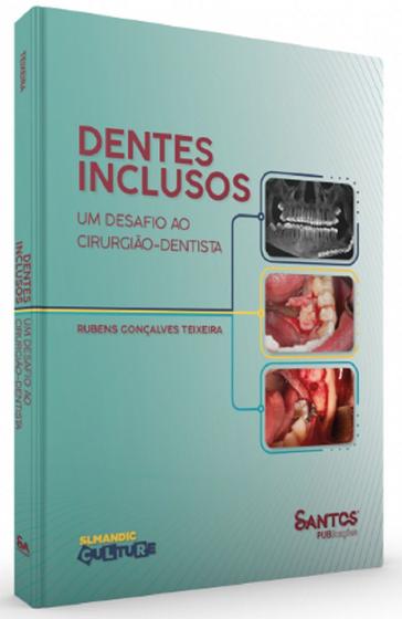 Imagem de Dentes Inclusos – Um Desafio ao Cirurgião-Dentista - Santos Publicações -  