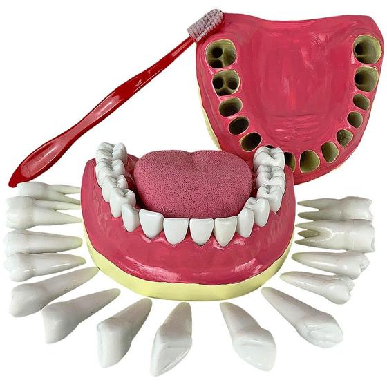 Imagem de Dentição com Todos os Dentes Removíveis, Anatomia