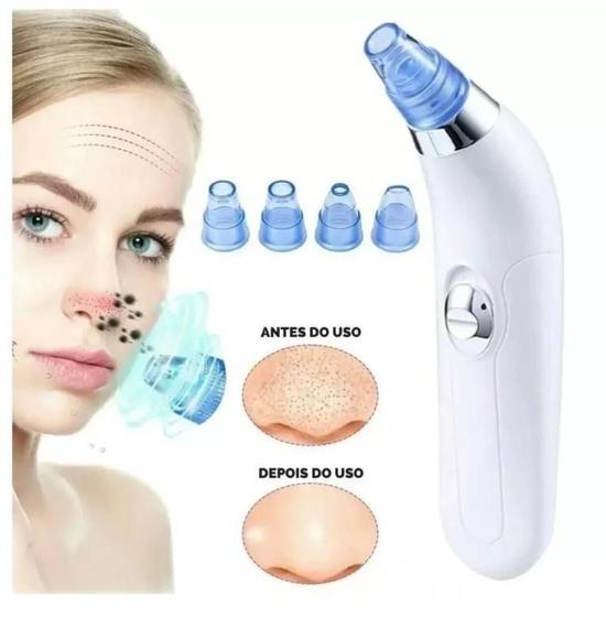 Imagem de Dermasuction Removedor De Cravos Espinhas Por Sucção