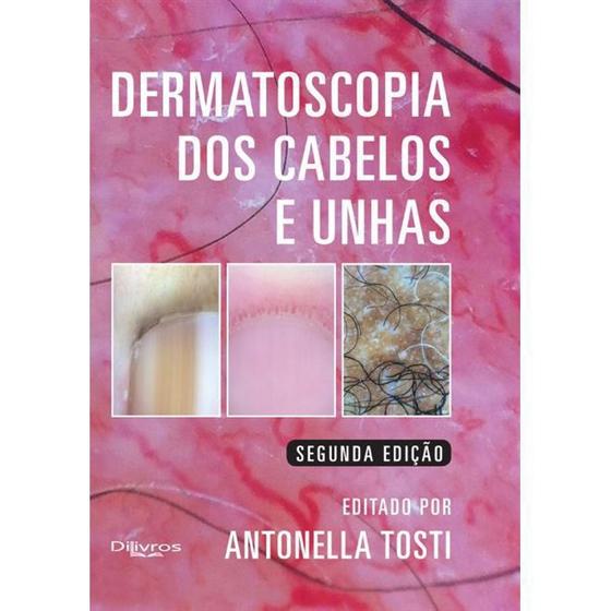 Imagem de Dermatoscopia dos cabelos e unhas