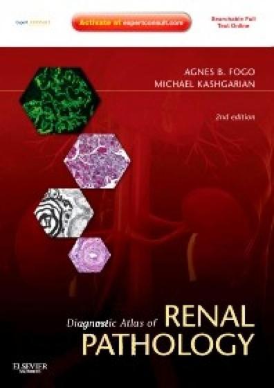 Imagem de Diagnostic atlas of renal pathology