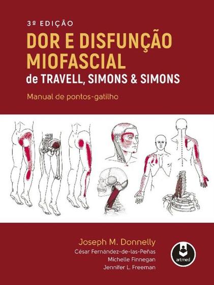 Imagem de Dor e Disfunção Miofascial de Travell, Simons & Simons