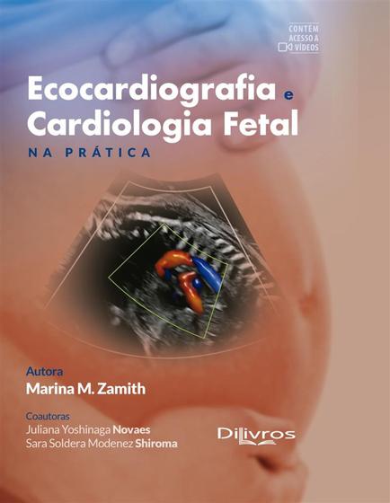 Imagem de Ecocardiografia e cardiologia fetal e pratica - Di Livros Editora Ltda