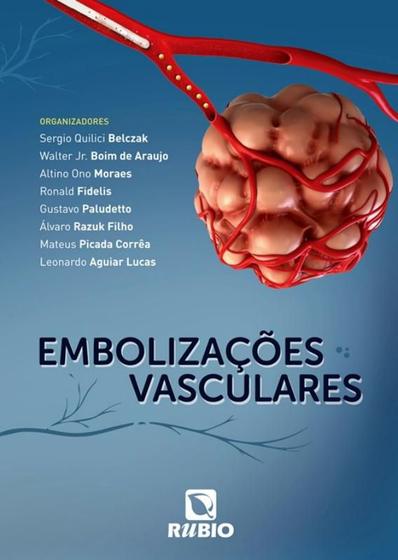 Imagem de EMBOLIZACOES VASCULARES -  