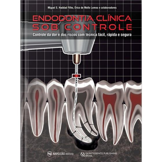 Imagem de Endodontia Clínica Sob Controle  Controle Da Dor E Dos Riscos Com Técnica Fácil, Rápida E Segura - Napoleão