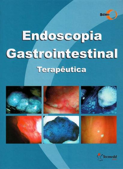 Imagem de Endoscopia Gastrointestinal Terapêutica