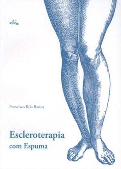 Imagem de Escleroterapia com espuma - FLU - FOLIUM