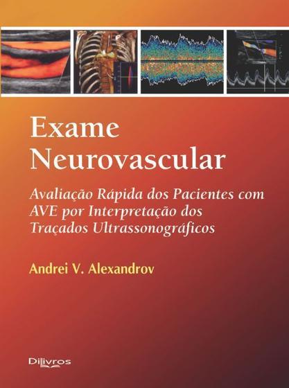 Exame Neurovascular - Avaliação Rápido Dos Pacientes Com AVE Por Interpretação Dos Traçados Ultras - DI LIVROS Menor preço em Exame Neurovascular - Avaliação Rápido Dos Pacientes Com AVE Por Interpretação Dos Traçados Ultras - DI LIVROS