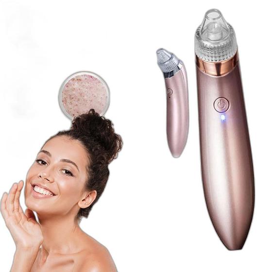 Imagem de Extrator Cravos Facial A Vácuo / Xn-8030 - Elétrico