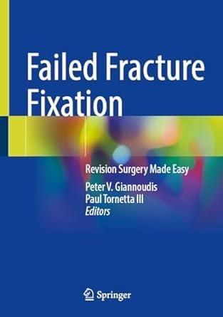Imagem de Failed fracture fixation - SPRINGER NATURE (IMPORT) 2024