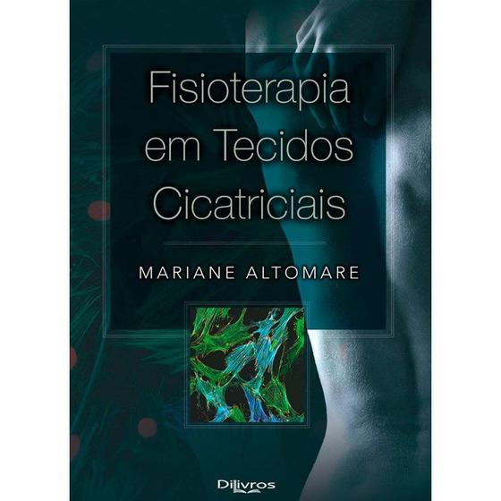 Imagem de Fisioterapia em tecidos cicatriciais - Di Livros Editora Ltda