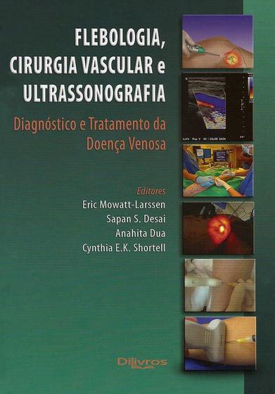 Imagem de Flebologia, Cirurgia Vascular e Ultrassonografia - Diagnóstico e Tratamento da Doença Venosa