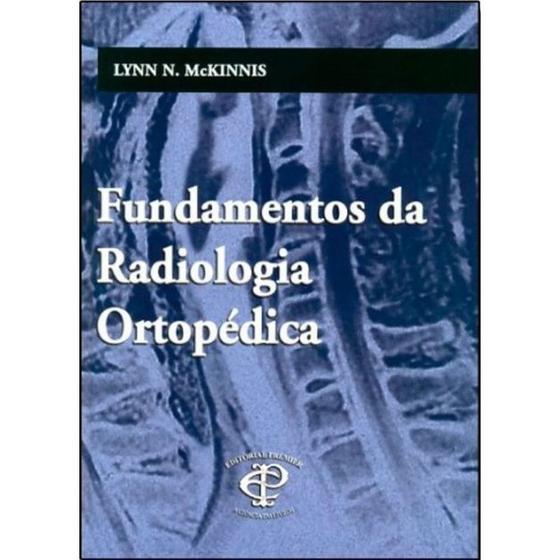 Imagem de Fundamentos da Radiologia Ortopédica - Premier