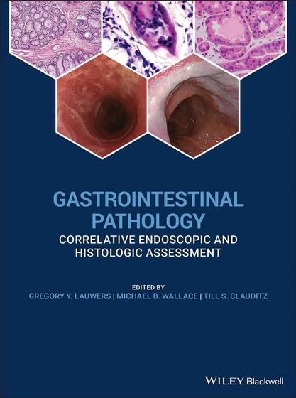Imagem de Gastrointestinal pathology correlative endoscopic and histologic assessment - John Wiley & Sons Inc