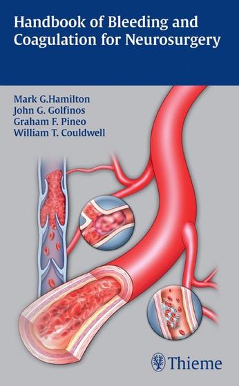 Imagem de Handbook of bleeding and coagulation for neurosurgery