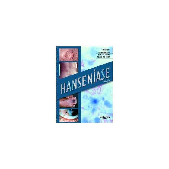 Imagem de Hanseníase - DI LIVROS