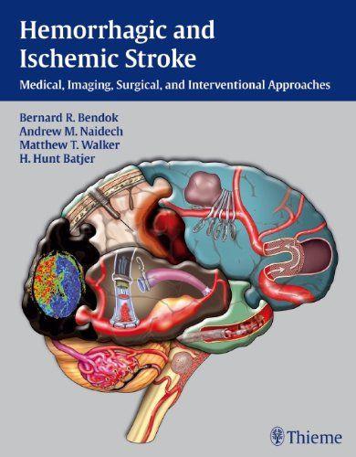 Imagem de Hemorrhagic and ischemic stroke - THIEME MEDICAL PUBLISHERS/MAPLE PRESS