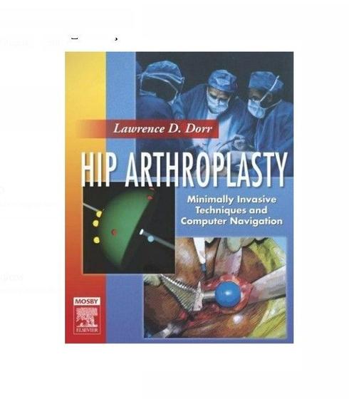 Imagem de Hip Arthroplasty: Minimally Invasive Techniques And Computer Navigation, te