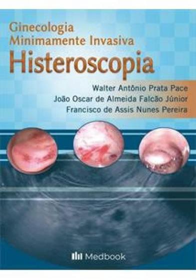 Imagem de Histeroscopia ginecologia minimamente invasiva - Med Book Editora Cientifica Ltda