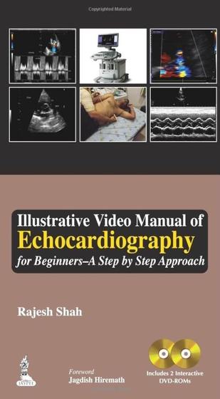 Imagem de Illustrative video manual of echocardiography for beginners a step by step