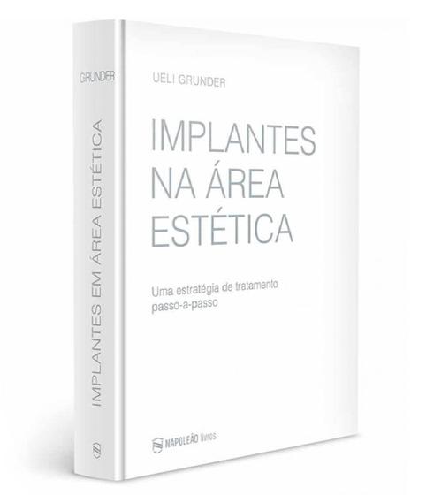 Imagem de Implantes Na Área Estética – Uma Estratégia De Tratamento Passo-A-Passo - Editora Napoleão