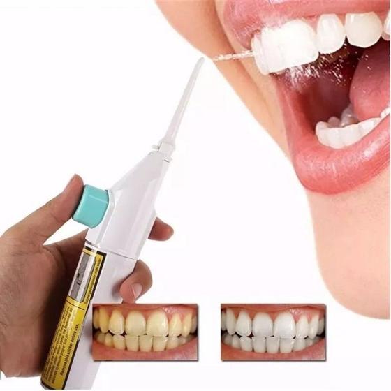 Imagem de Irrigadores Limpeza Oral Higiene Dental Saúde Bucal