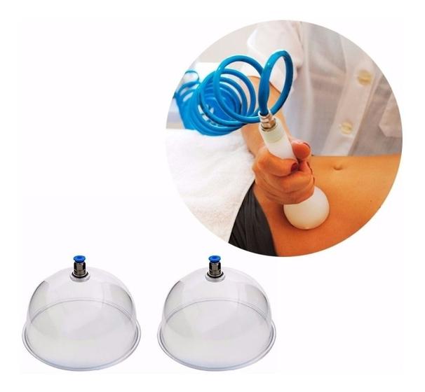 Imagem de Kerigma - kit pump up 17cm/8mm + ventosa de endermo