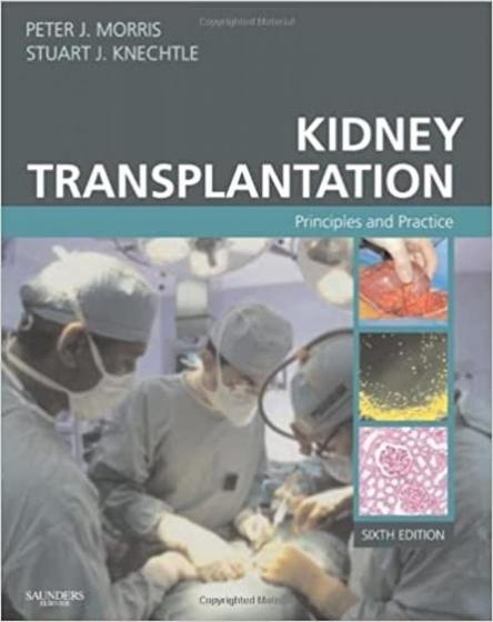 Imagem de Kidney transplantation. principles and practice - W.B. SAUNDERS