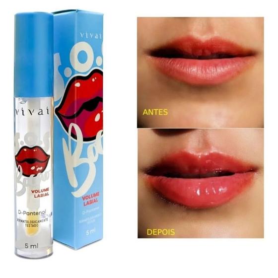Imagem de KIT 2 Gloss SOS Bocão Aumenta Lábios VIVAI Hidratação 5ml