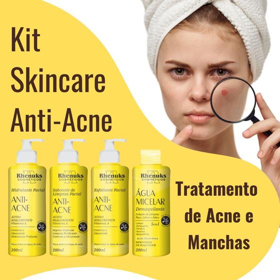 Imagem de Kit Anti-Acne Skincare Tratamento Facial e Limpeza de Pele - Rhenuks