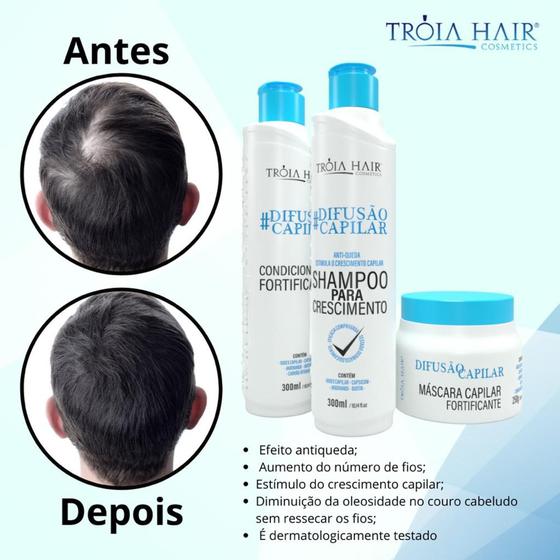 Imagem de Kit Crescimento Difusão Capilar Tróia Hair