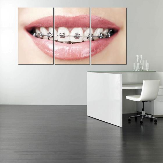 Imagem de Kit Quadro Decorativo em MDF Para Dentista - Aparelho