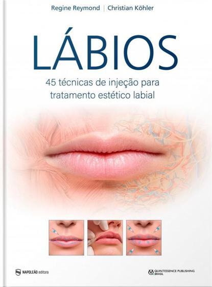 Imagem de Labios: 45 tecnicas de injecao para tratamento estetico labial - Ed Napoleao -  