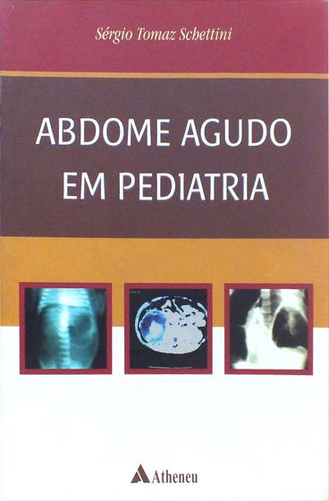 Imagem de Livro - Abdome agudo em pediatria