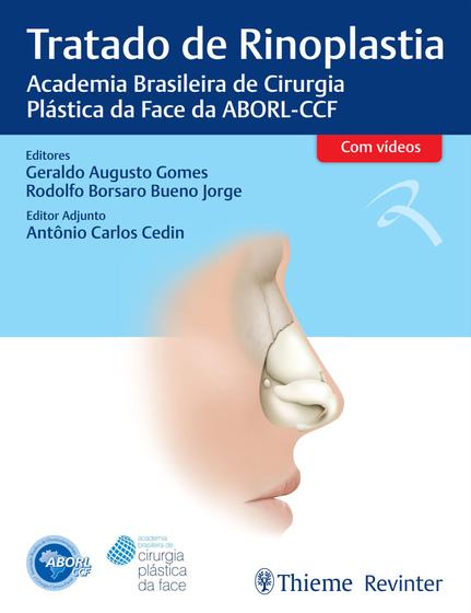 Imagem de Livro - ABORL Tratado de Rinoplastia