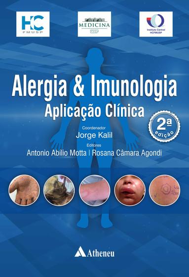 Livro - Alergia e Imunologia – Aplicação Clínica - Livros de Medicina ...