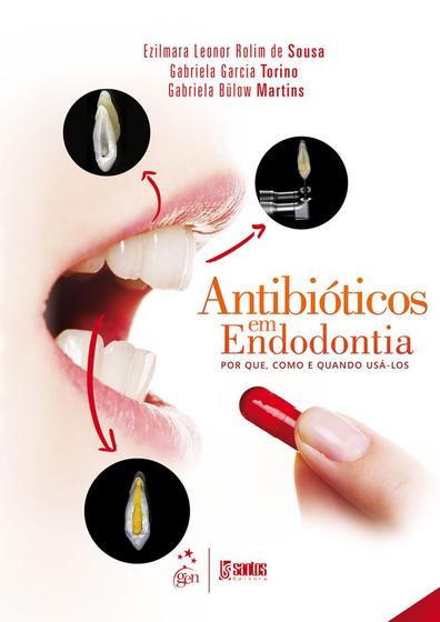Imagem de Livro - Antibiótico em Endodontia - Por que, como e quando usá-los