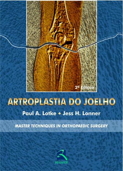 Imagem de Livro - Artroplastia do Joelho