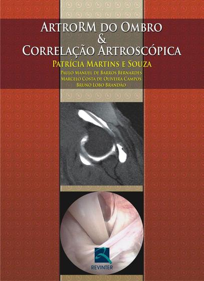 Imagem de Livro - ArtroRM do Ombro & Correlação Artroscópica