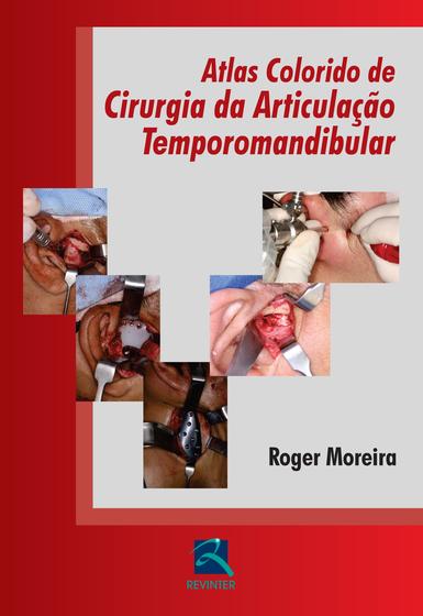 Livro - Atlas Colorido de Cirurgia da ATM Menor preço em Livro - Atlas Colorido de Cirurgia da ATM