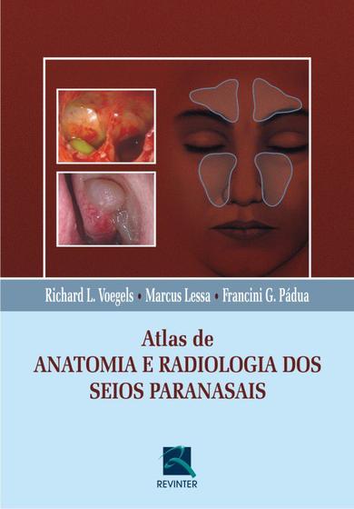 Imagem de Livro - Atlas de Anatomia e Radiologia dos Seios Paranasais