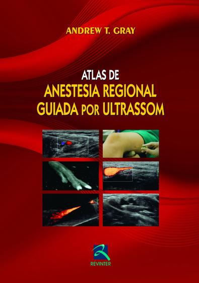 Imagem de Livro - Atlas de Anestesia Regional Guiada por Ultrassom