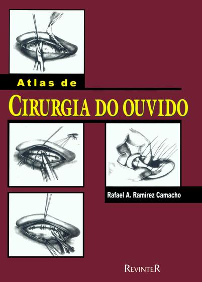 Imagem de Livro - Atlas de Cirurgia do Ouvido