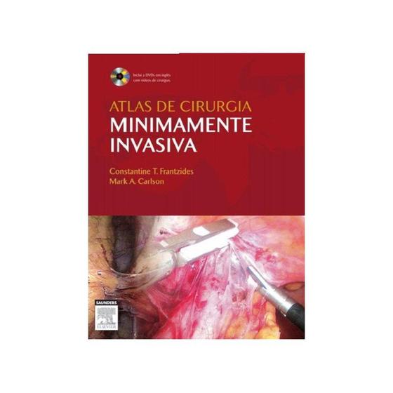 Livro - Atlas de Cirurgia Minimamente Invasiva - Frantzides Menor preço em Livro - Atlas de Cirurgia Minimamente Invasiva - Frantzides