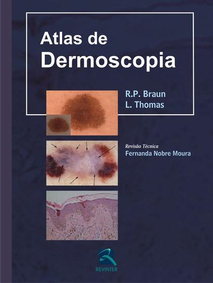 Imagem de Livro - Atlas de Dermoscopia