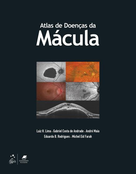 Imagem de Livro - Atlas de Doenças da Mácula