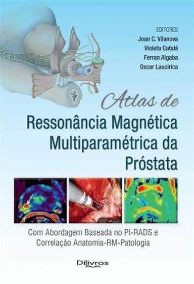 Livro Atlas De Ressonancia Magnetica Multiparametrica Da Prostata - Di Livros Menor preço em Livro Atlas De Ressonancia Magnetica Multiparametrica Da Prostata - Di Livros