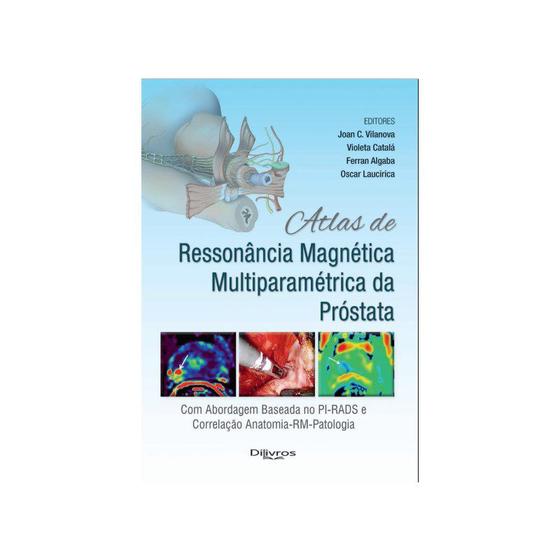 Imagem de Livro -  Atlas de Ressonâncias Magnéticas  Multiparamétrica da Próstata - Vilanova - DiLivros