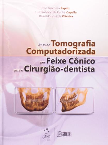 Imagem de Livro - Atlas de Tomografia Computadorizada por Feixe Cônico para o Cirurgião-Dentista