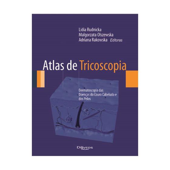 Imagem de Livro - Atlas de Tricoscopia - Dermatoscopia das Doenças do Couro Cabeludo e dos Pelos - Rudinicka - DiLivros